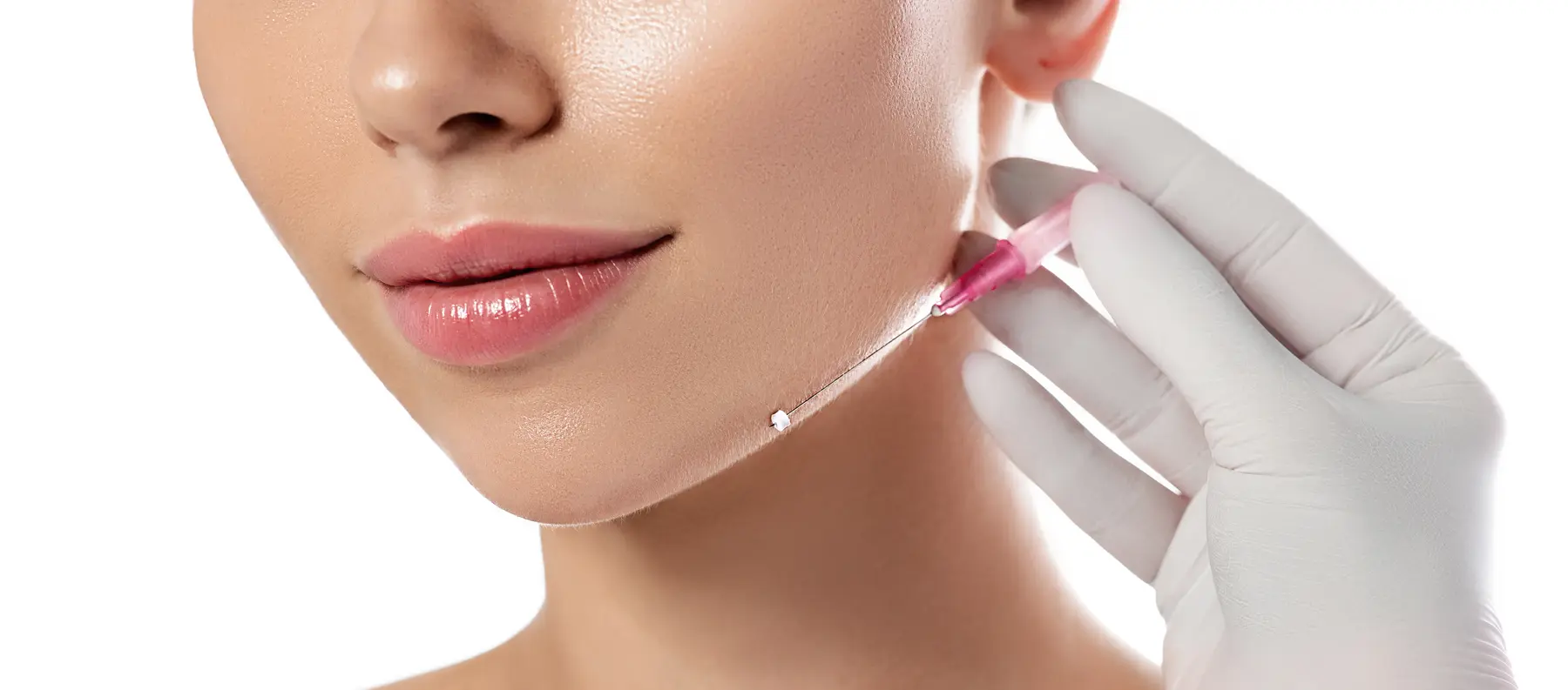 Dermal filler injection in a woman chin for cosmetic enhancement in Cupertino
